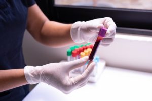 blood analysis for chronic hepatitis treatment